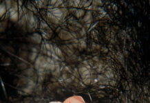 Echidna microbiome changes while mums nurse their puggles